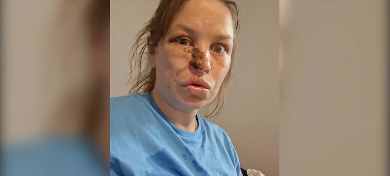 Pregnant Woman Severely Injured in Dog Attack in Topeka