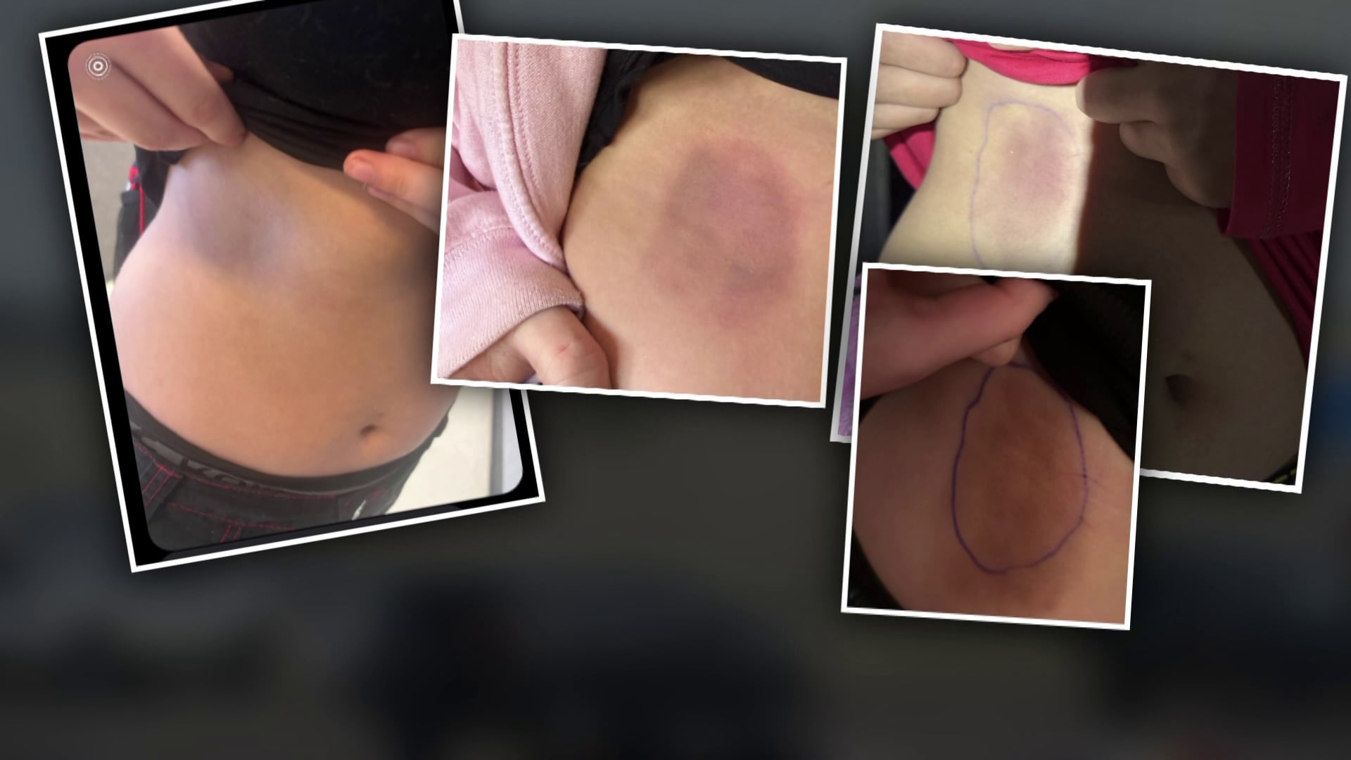 Arizona Teen Charged with Assault After Dodgeball Game