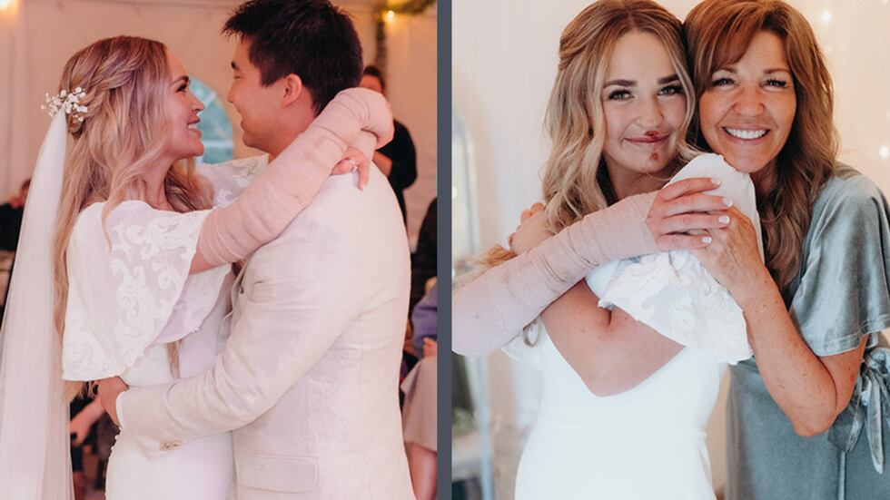 Despite her injuries, Lydia was able to walk down the aisle to marry Alex.