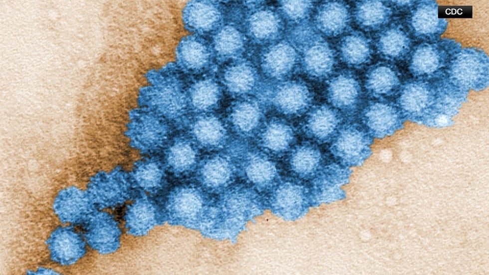 Norovirus outbreak confirmed at metro area elementary school with approximately 85 cases reported 1 Norovirus