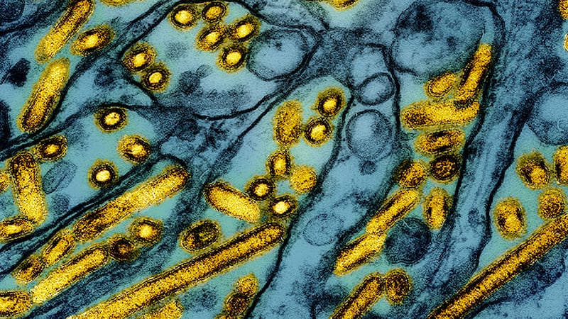 This colorized electron microscope image released by the National Institute of Allergy and...